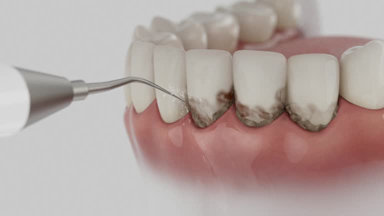 Reliable Wisdom Tooth Removal contractor in Knightsen, CA by Smile Center Dentistry